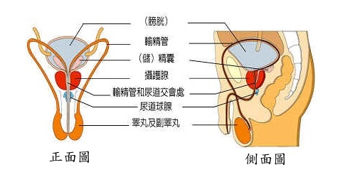 精囊炎治疗要花费多少钱?